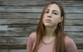 یک زن جوان که صورت او پر از آکنه است