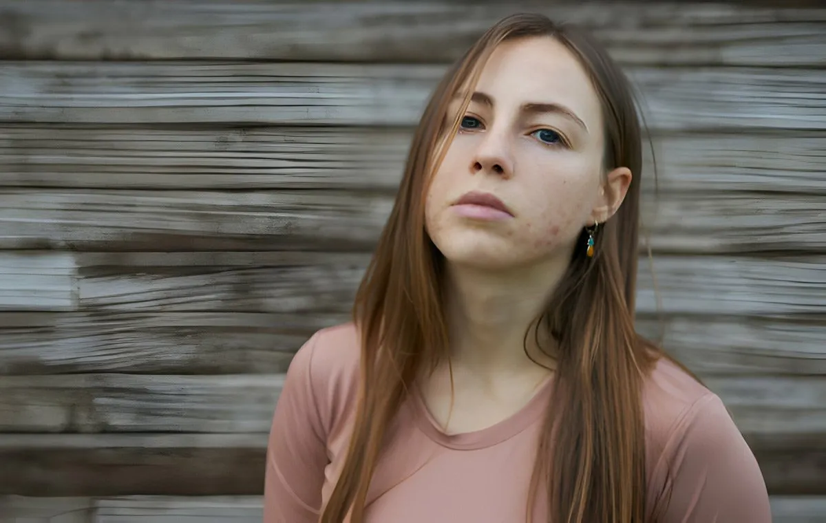 یک زن جوان که صورت او پر از آکنه است