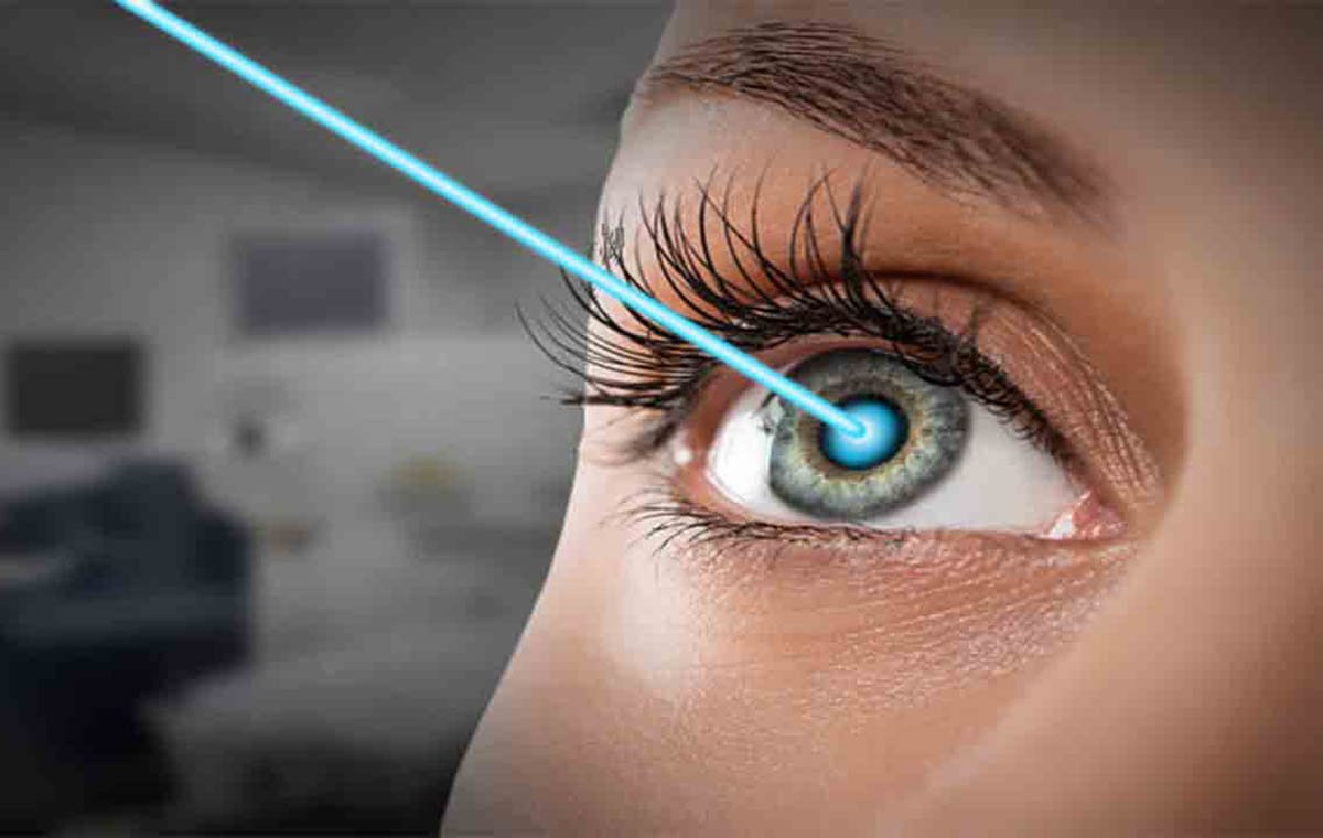 جراحی تغییر رنگ چشم چیست؟