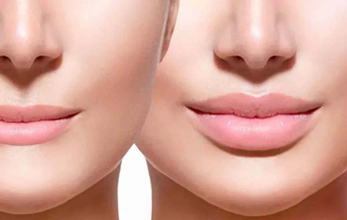 عمل لیفت سانترال لب