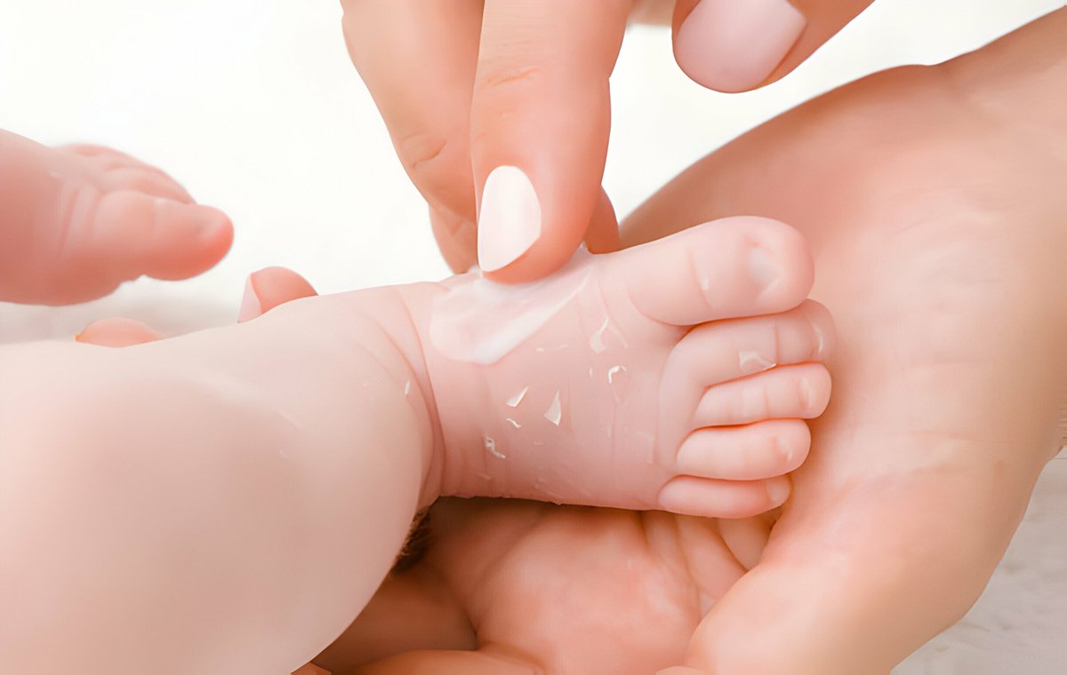 خشکی پوست بدن در کودکان و نوزادان