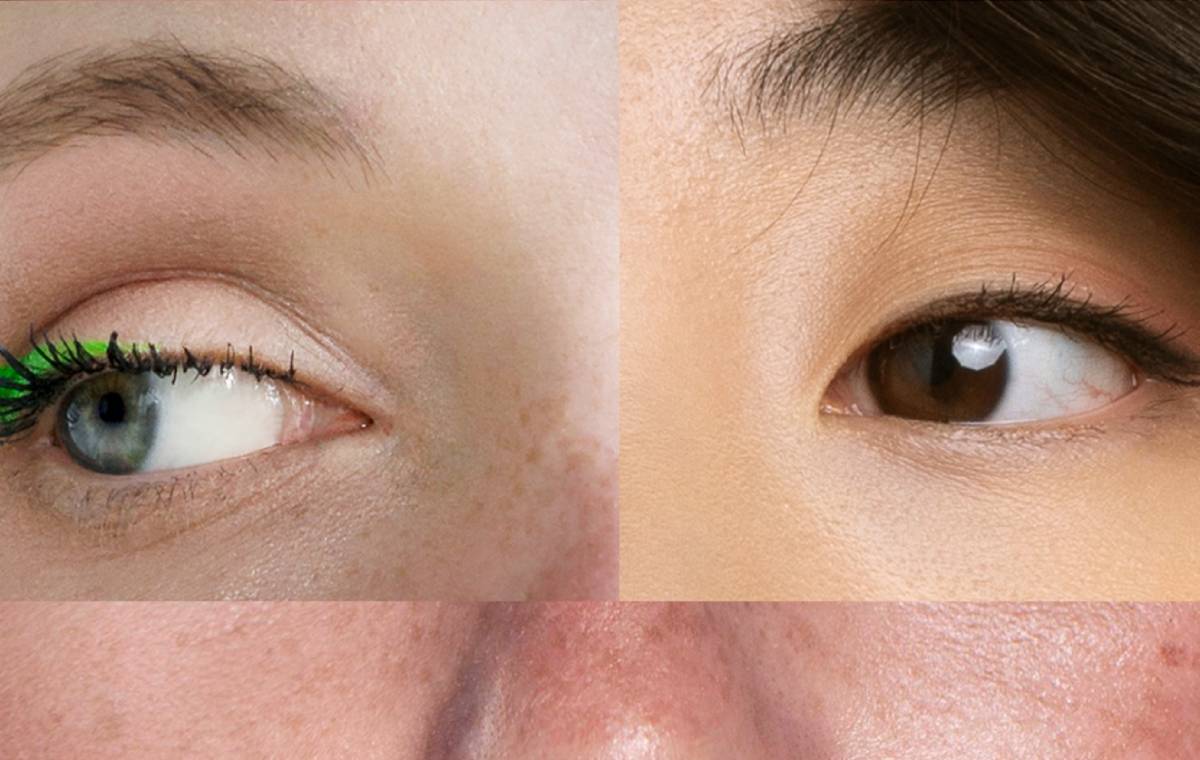 تصویر تلفیقی از دو کیفیت یک پوست