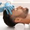یک پزشک که آموزش مزوتراپی مو دیده است، محلول دارویی را به سر مرد جوان تزریق می‌کند