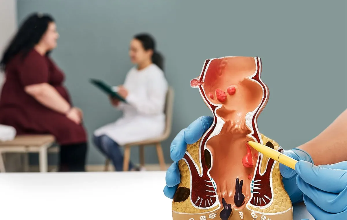 درمان بیماری شقاق