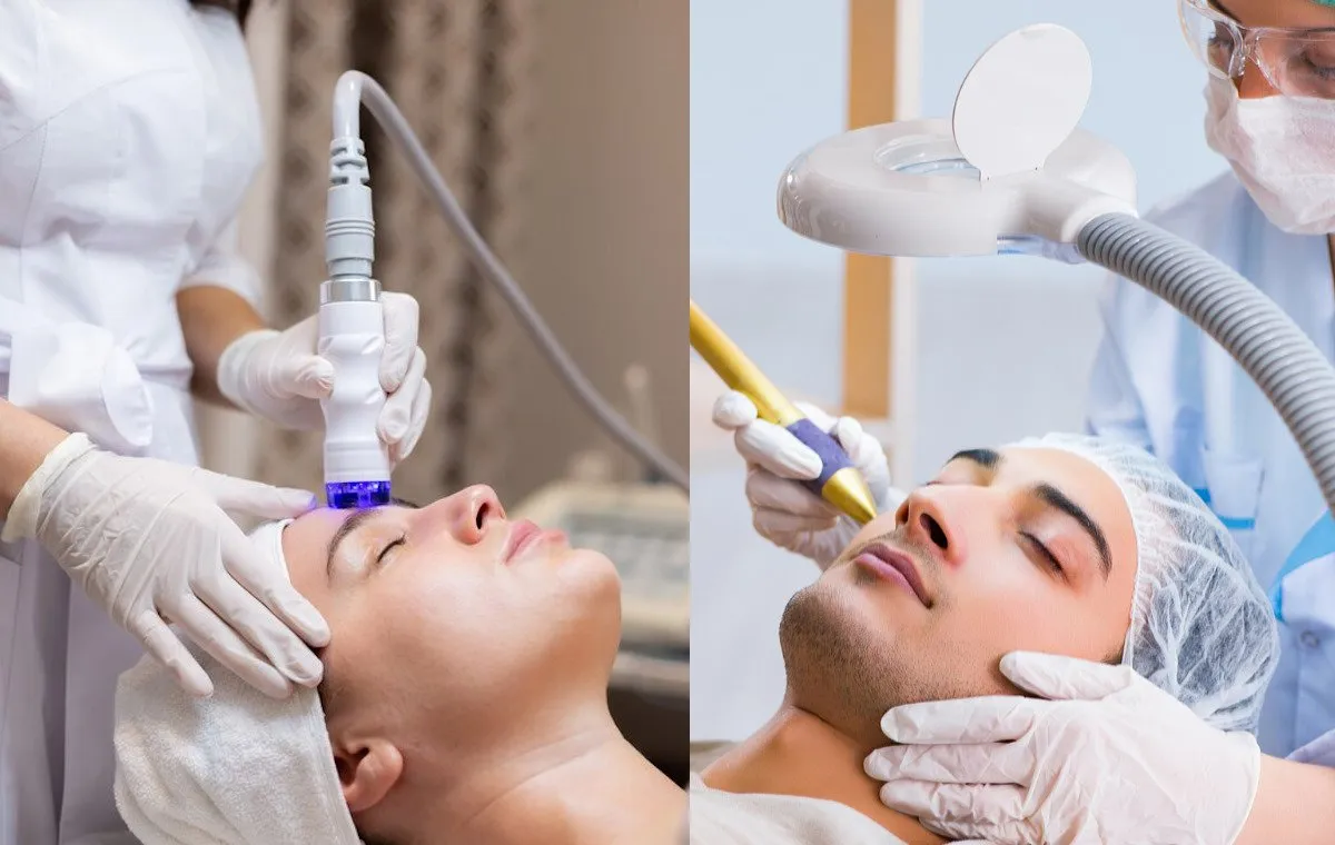 انواع لیزر برای پوست صورت