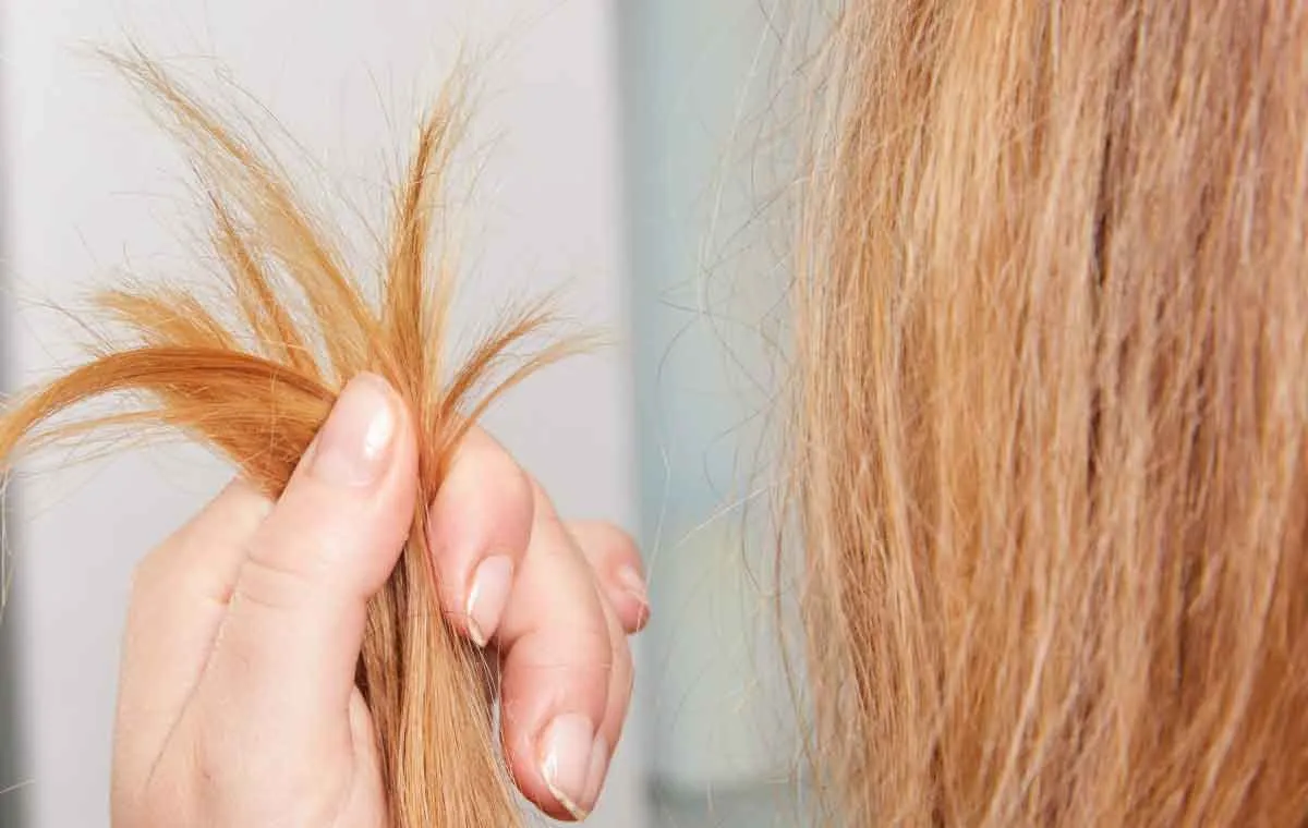 رفع موخوره با اوزون تراپی