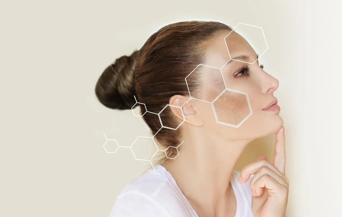 هایپرپیگمنتیشن چیست؟