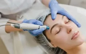 میکرودرم ابریژن چیست و چه فایده‌ای برای پوست دارد؟