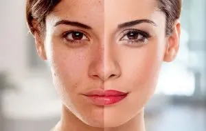 کرم سفید کننده قوی صورت