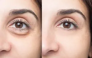 بهترین کرم دور چشم بالای 40 سال