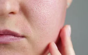 بهترین کرم جمع‌کننده منافذ پوست