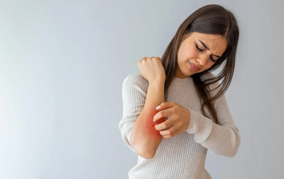 راههای درمان درماتیت