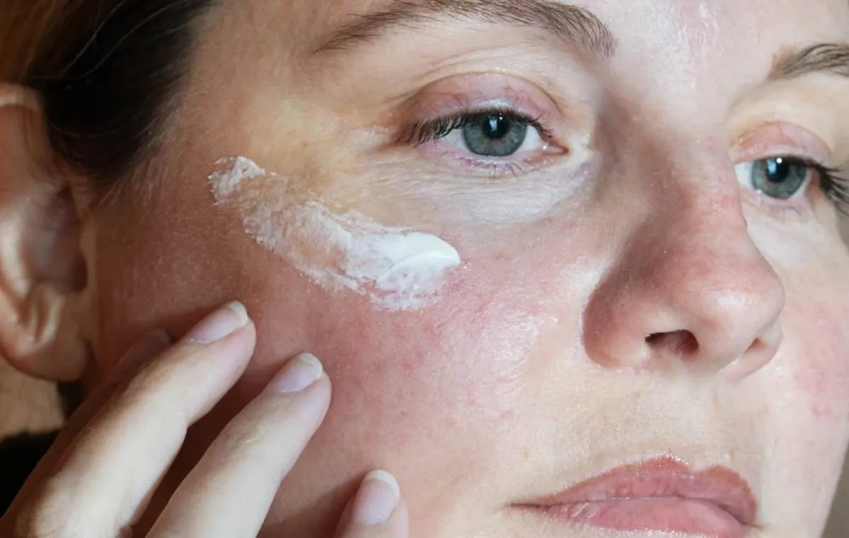 موارد استفاده از پماد آزلادرم