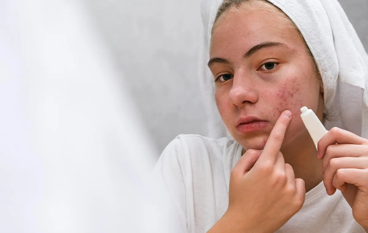 پماد ترتینوئین برای چیست؛ کاربرد، عوارض و نحوه مصرف آن