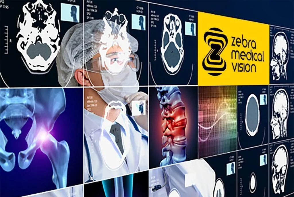 زبرا مدیکال ویژن (Zebra Medical Vision) بهترین هوش مصنوعی پزشکی 