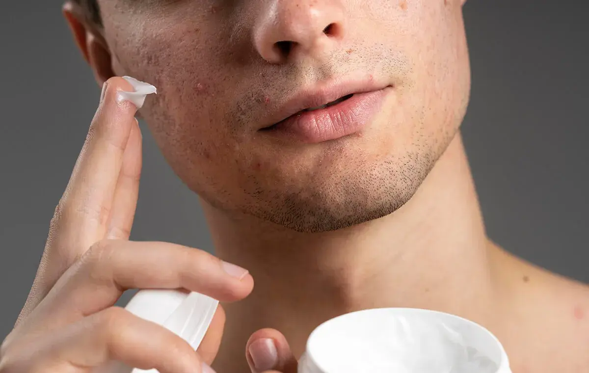 عکس پماد زینک اکساید برای لک صورت