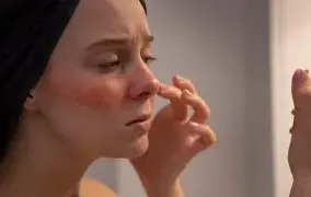 بهترین ماسک برای آفتاب سوختگی صورت