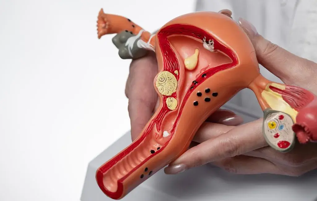 عوارض قرص سیپروفلوکساسین برای عفونت رحم