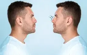 نکروز بینی چیست