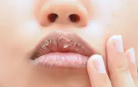 بهترین روغن برای خشکی لب؛ راهنمای انتخاب برای لب‌های نرم و شاداب