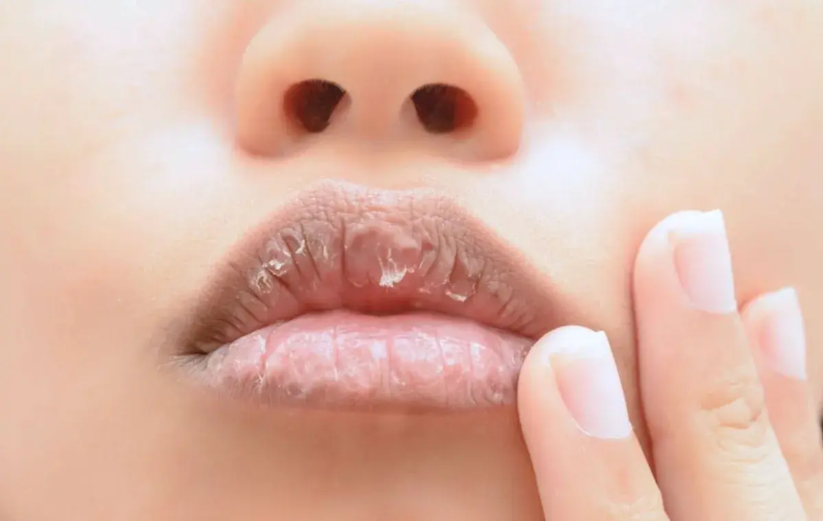 بهترین روغن برای خشکی لب؛ راهنمای انتخاب برای لب‌های نرم و شاداب