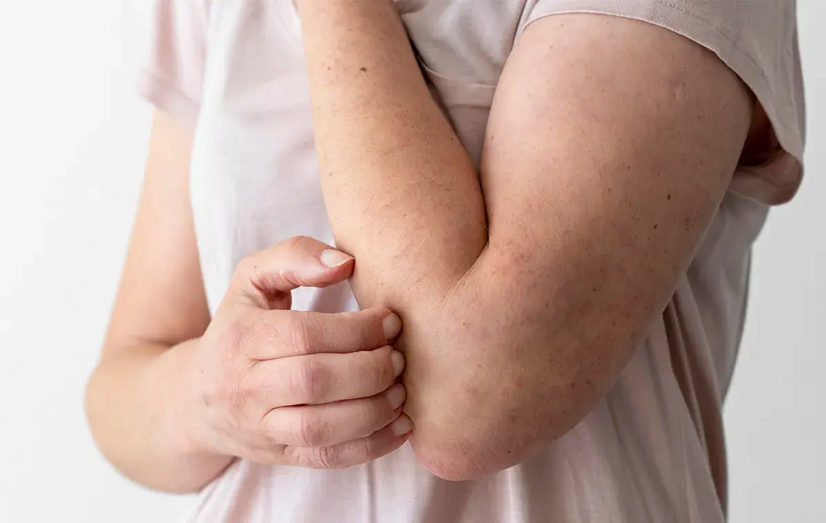 بهترین دارو برای خارش بدن 