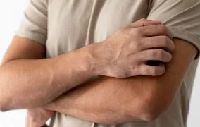 بهترین دارو برای خارش بدن