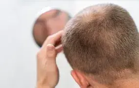 شامپوی موهای کاشته شده ژاک آندرل پاریس