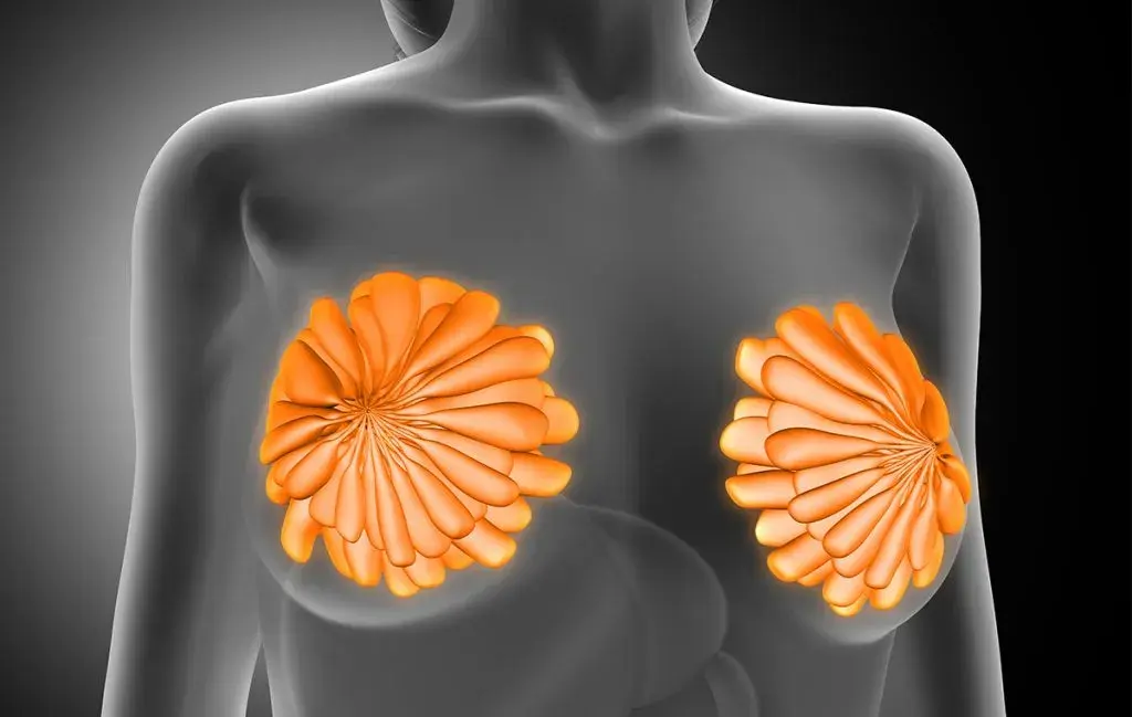 عوارض عمل ماموپلاستی