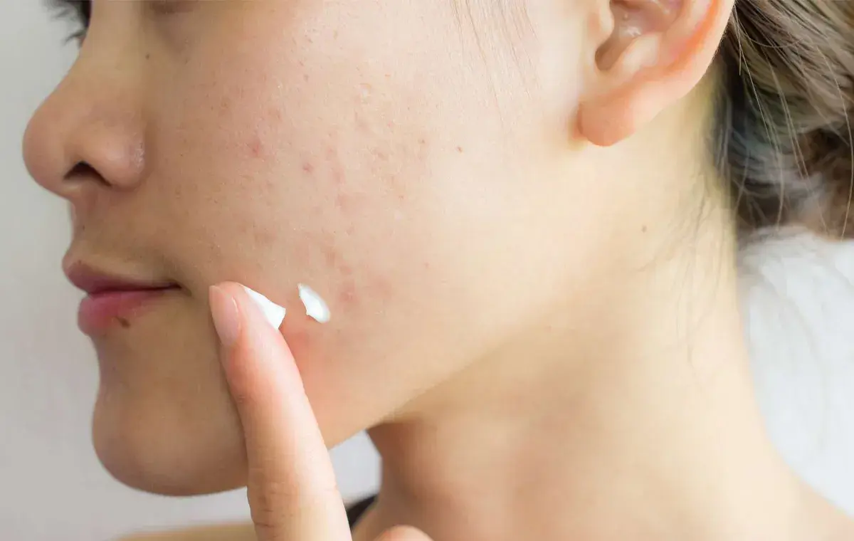 عوارض احتمالی استفاده از خمیردندان روی پوست صورت