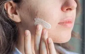 از بین بردن لک صورت با خمیردندان