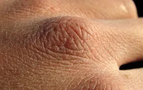 مضررات الکل لوازم بهداشتی برای پوست