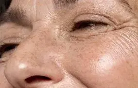 از بین بردن خط اخم به روش خانگی؛ راهکارهای ساده و موثر