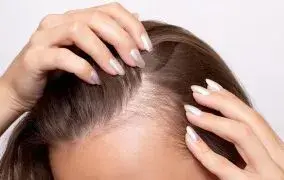 بهترین شامپو برای ریزش مو خانم‌ها؛ تقویت مو از ریشه