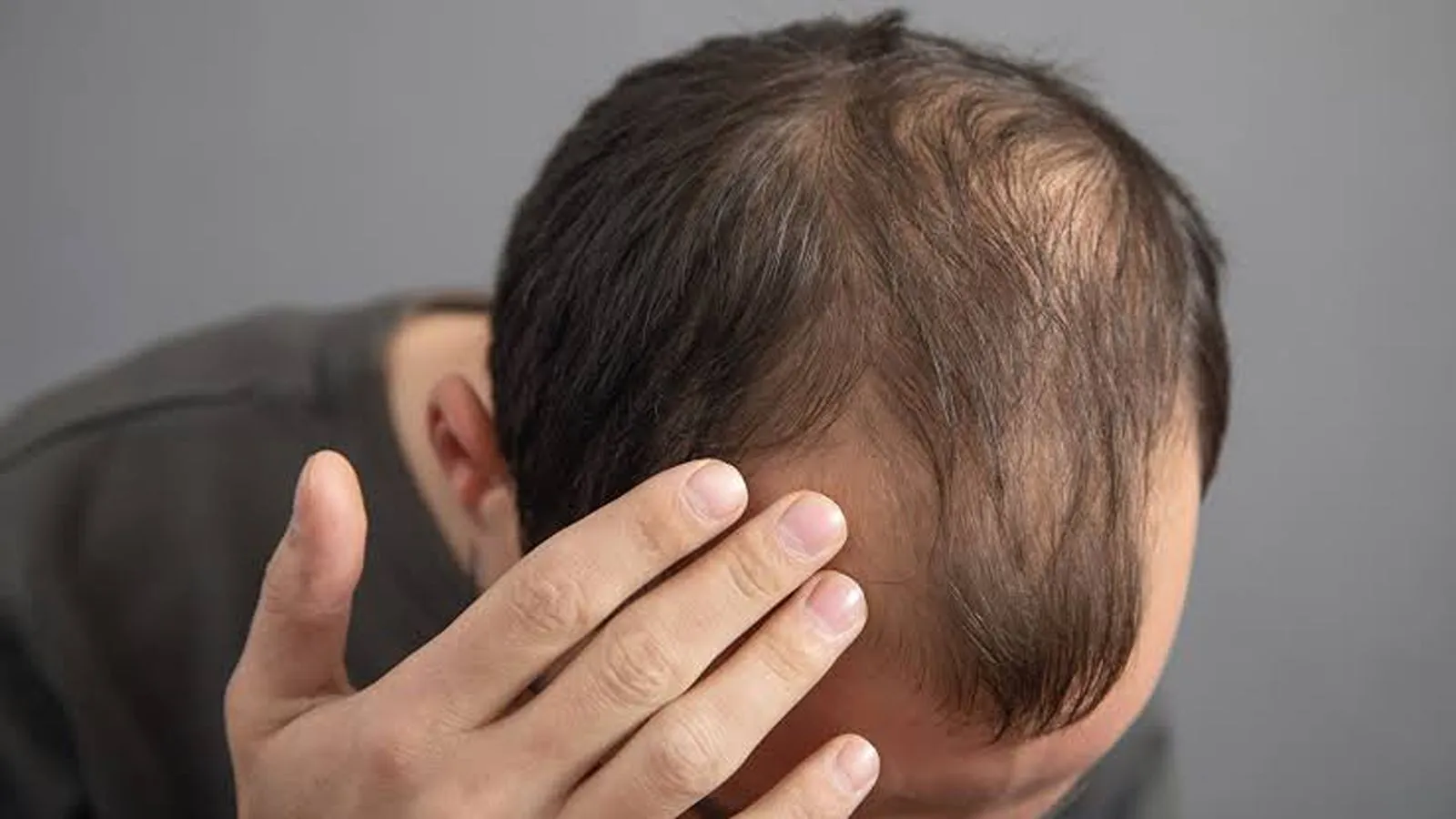 بهترین شامپو ضدریزش مو آقایان