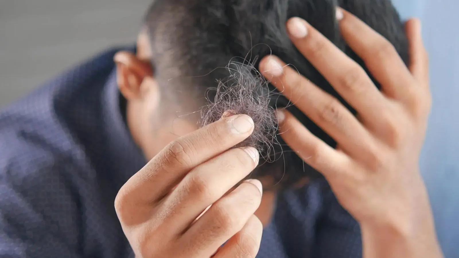 بهترین شامپو ضدریزش مو آقایان